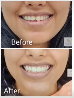 Slider image (10) Dr. A & T Dental Experts